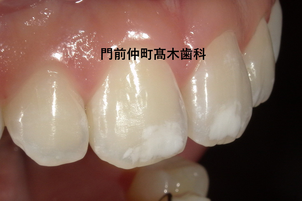 治療前