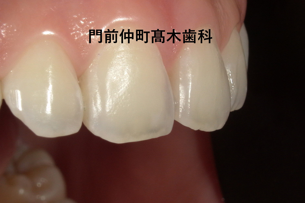 治療後