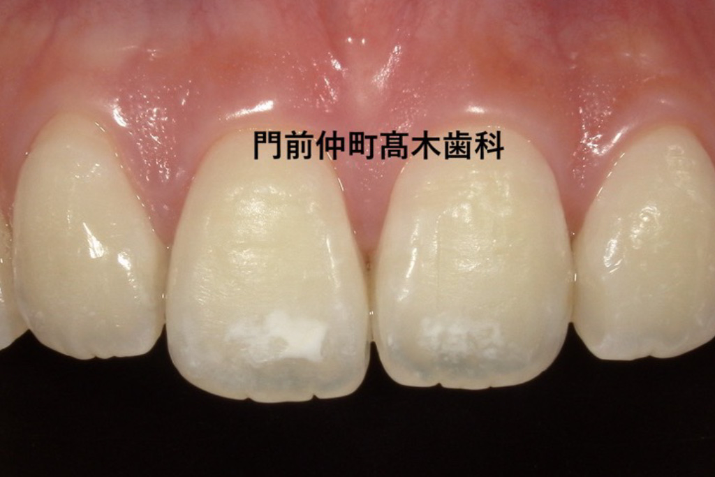 治療前