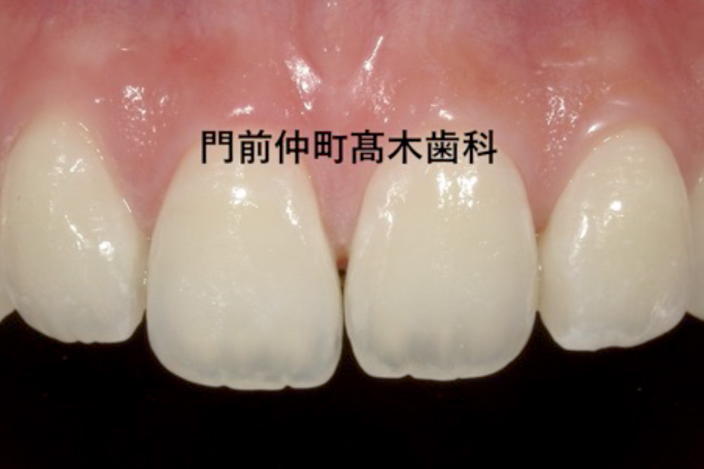 治療後
