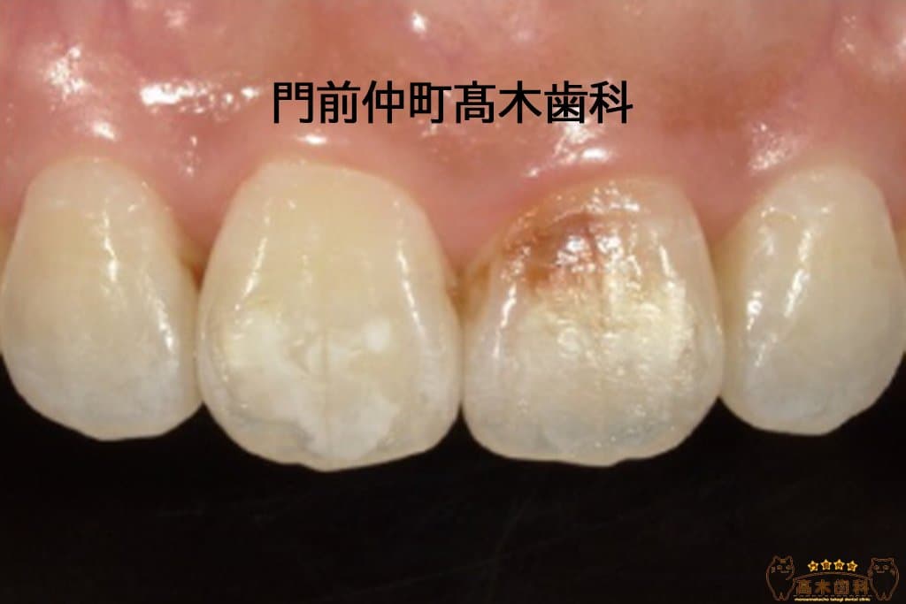治療前