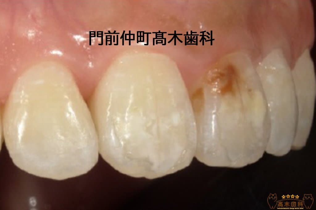 治療前