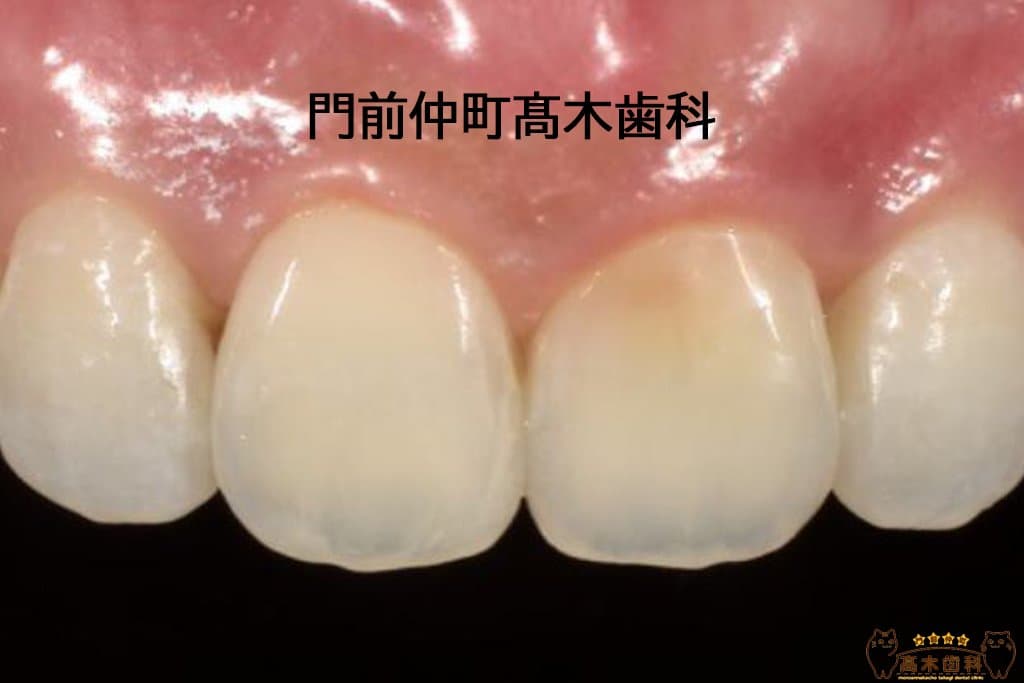 治療後