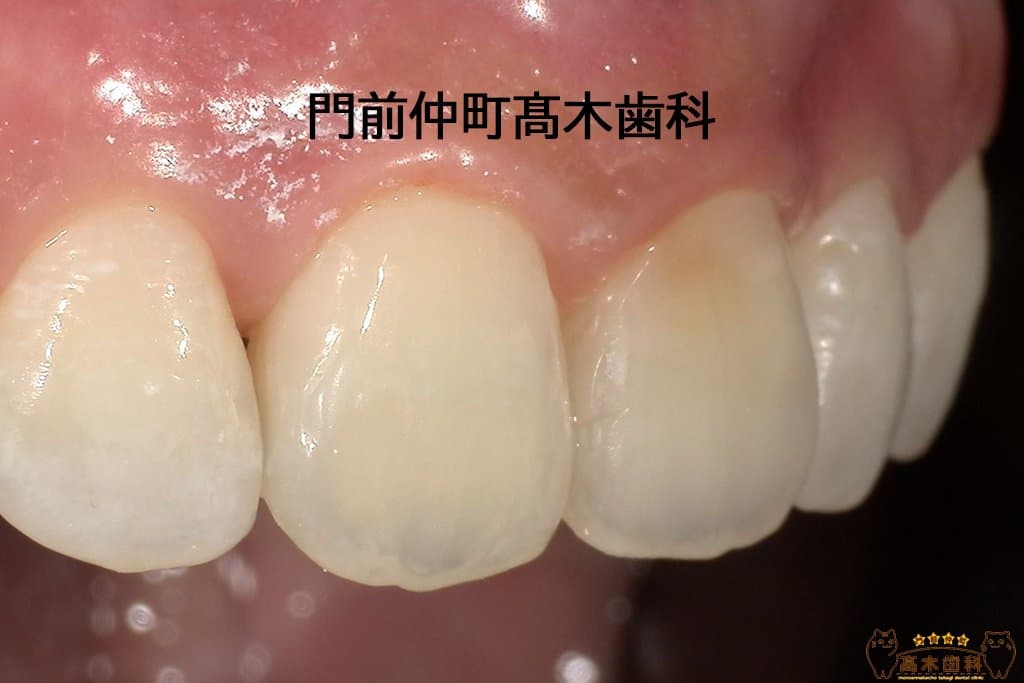 治療後