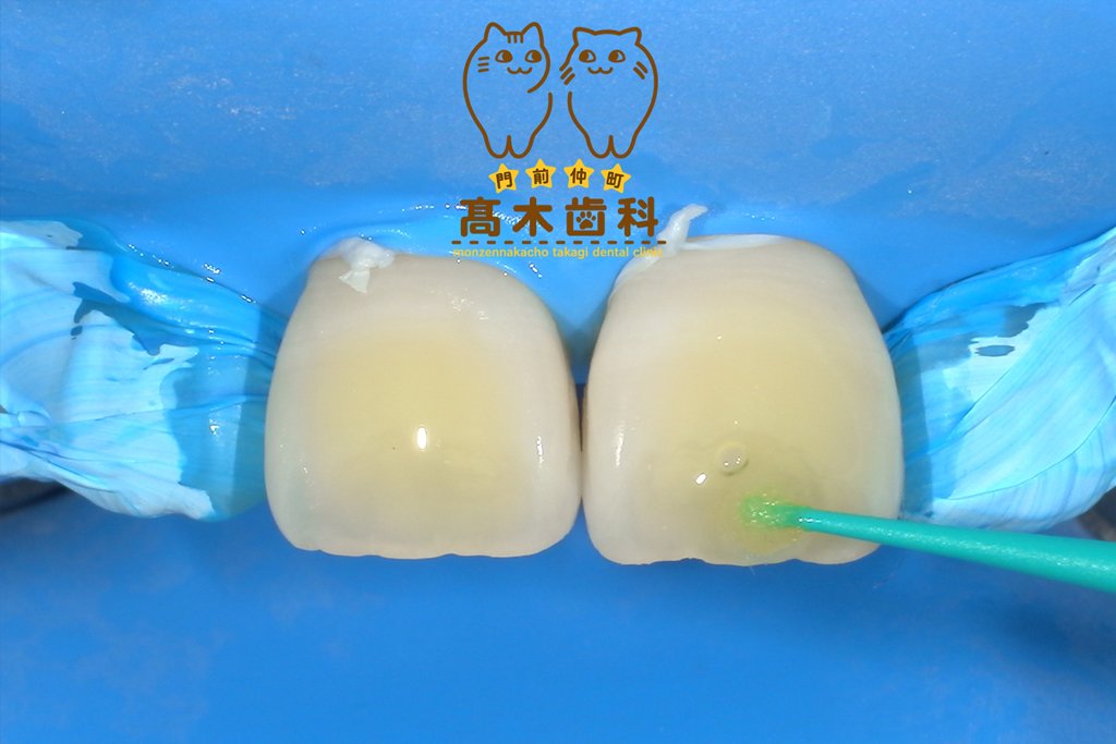 治療前