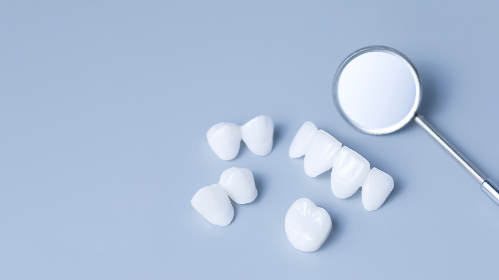 セラミックによる虫歯治療のメリット・デメリット
