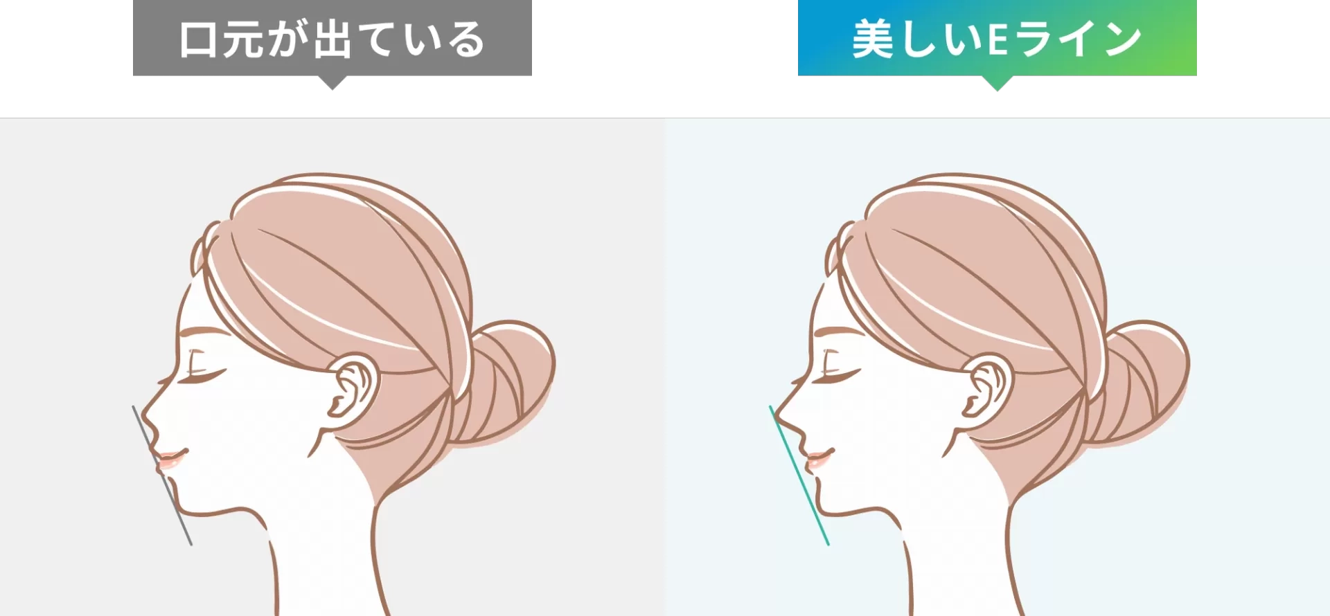 矯正治療を検討されている方へ